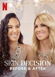 Skin Decision: Before and After tv show poster