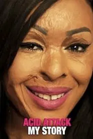 Poster do filme Acid Attack: My Story