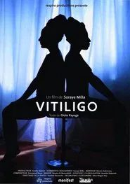 Vitiligo movie poster
