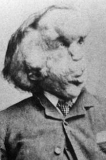 Joseph Merrick profile picture