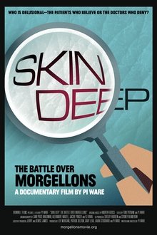 Skin Deep: The Battle Over Morgellons movie poster