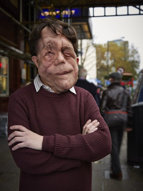 The Ugly Face of Disability Hate Crime movie poster