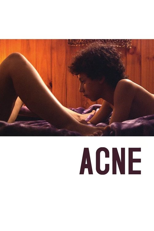 Acne movie poster