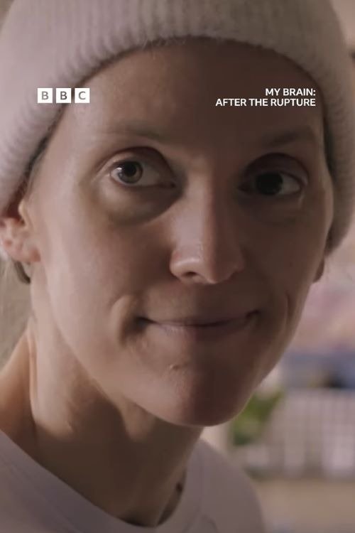 My Brain: After the Rupture movie poster