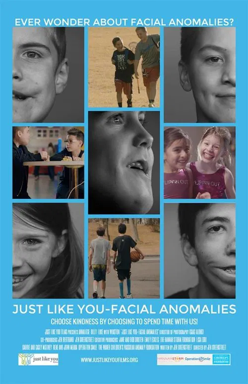 Just Like You: Facial Anomalies movie poster
