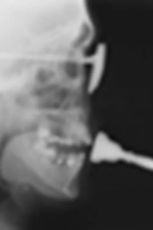 Poster do filme Studies in Diagnostic Cinefluorography