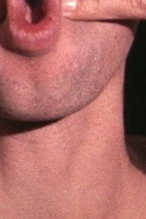 Pinchneck movie poster